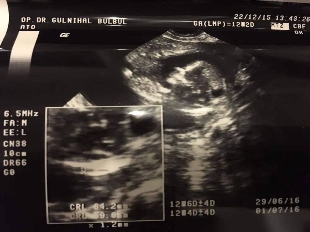 Mine’nin Hamilelik Günlüğü: 1. Trimester