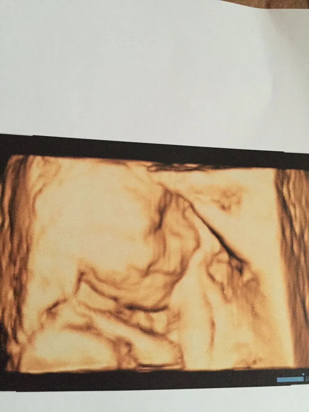 Mine’nin Hamilelik Günlüğü: 2. Trimester